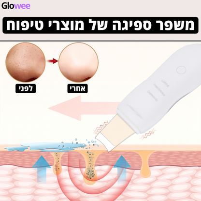 GloweePro™ - מסיר שחורים חכם