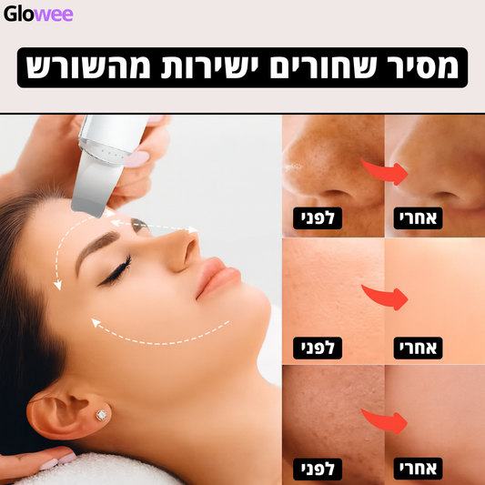 GloweePro™ - מסיר שחורים חכם